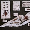 elementanat1site I. L'humain et ses parasites