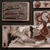 elementanat3site III. Naissance